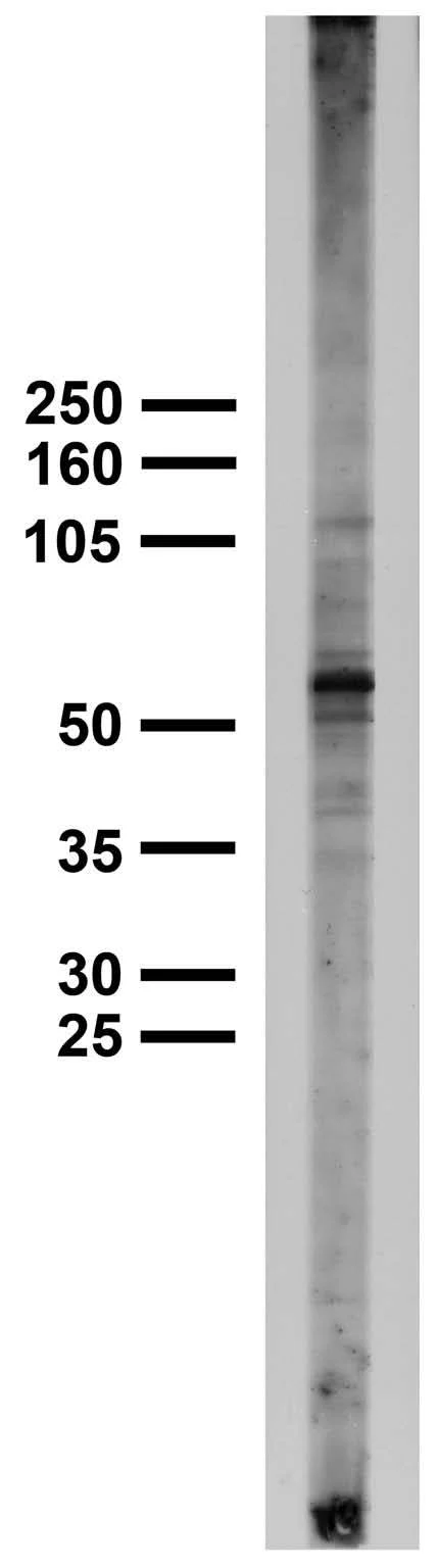 Anti-Pink1 PTEN Induced Putative Kinase 1 Antibody