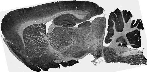 Anti-Pink1 PTEN Induced Putative Kinase 1 Antibody - Image 2