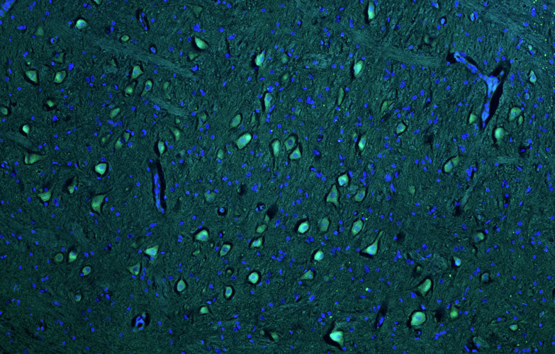Anti-Pink1 PTEN Induced Putative Kinase 1 Recombinant Chicken Chimeric mAb