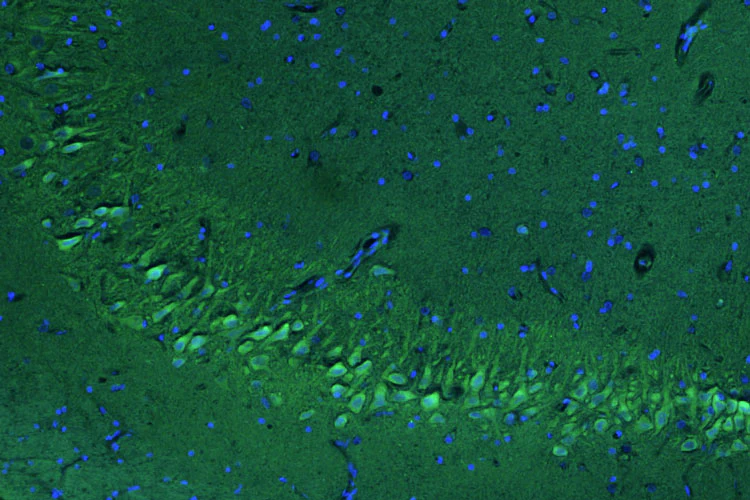 Anti-Pink1 PTEN Induced Putative Kinase 1 Recombinant Chicken Chimeric mAb - Image 3