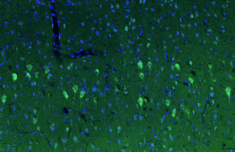 Anti-Pink1 PTEN Induced Putative Kinase 1 Recombinant Chicken Chimeric mAb - Image 4