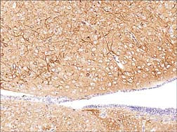 Anti-PKCα (Central region) Antibody - Image 2