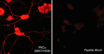 Anti-PKCα (Ser-657/Tyr-658), Phosphospecific Antibody - Image 2