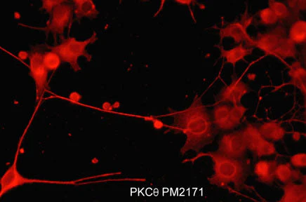 Anti-PKCθ (N-terminal region) Antibody - Image 2