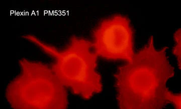Anti-Plexin A1 (Sema Domain) Antibody - Image 2