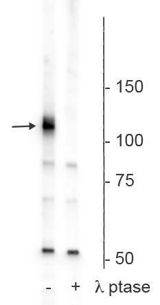 Anti-Polo-Like Kinase Kinase (Ser482,486,490) Antibody