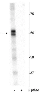 Anti-PRAS40 (Thr356) Antibody