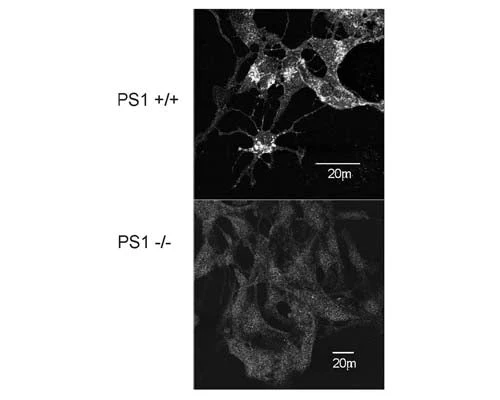 Anti-Presenilin 1 (PS-1) Antibody - Image 2