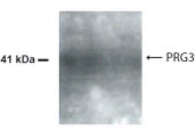 Anti-PRG3 Antibody
