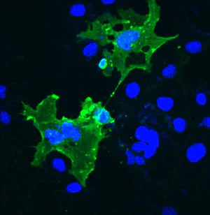 Anti-Prion Protein Antibody