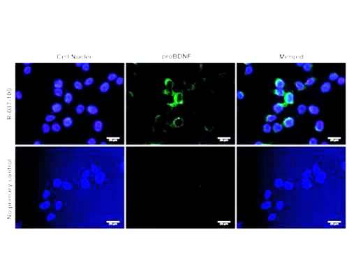 Anti-pro-Brain-derived neurotrophic factor (proBDNF) Antibody