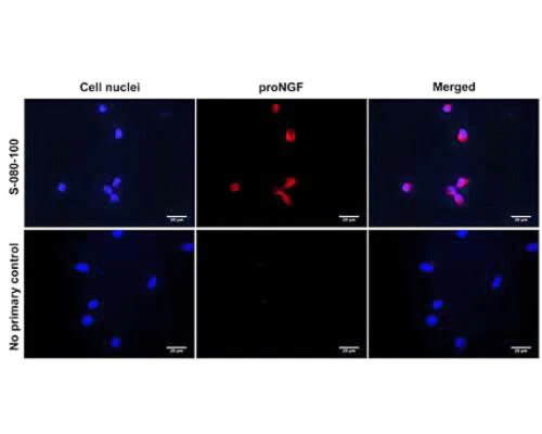 Anti-pro-Brain-derived neurotrophic factor (proBDNF) Antibody - Image 2