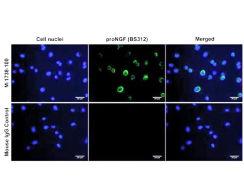 Anti-Pro-nerve growth factor (proNGF) Antibody - Image 2