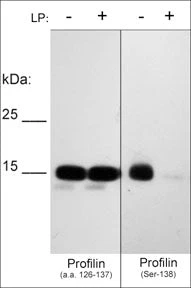 Anti-Profilin (Ser-138), Phosphospecific Antibody - Image 2