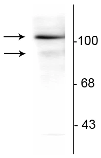 Anti-Progesterone Receptor (Ser294) Antibody