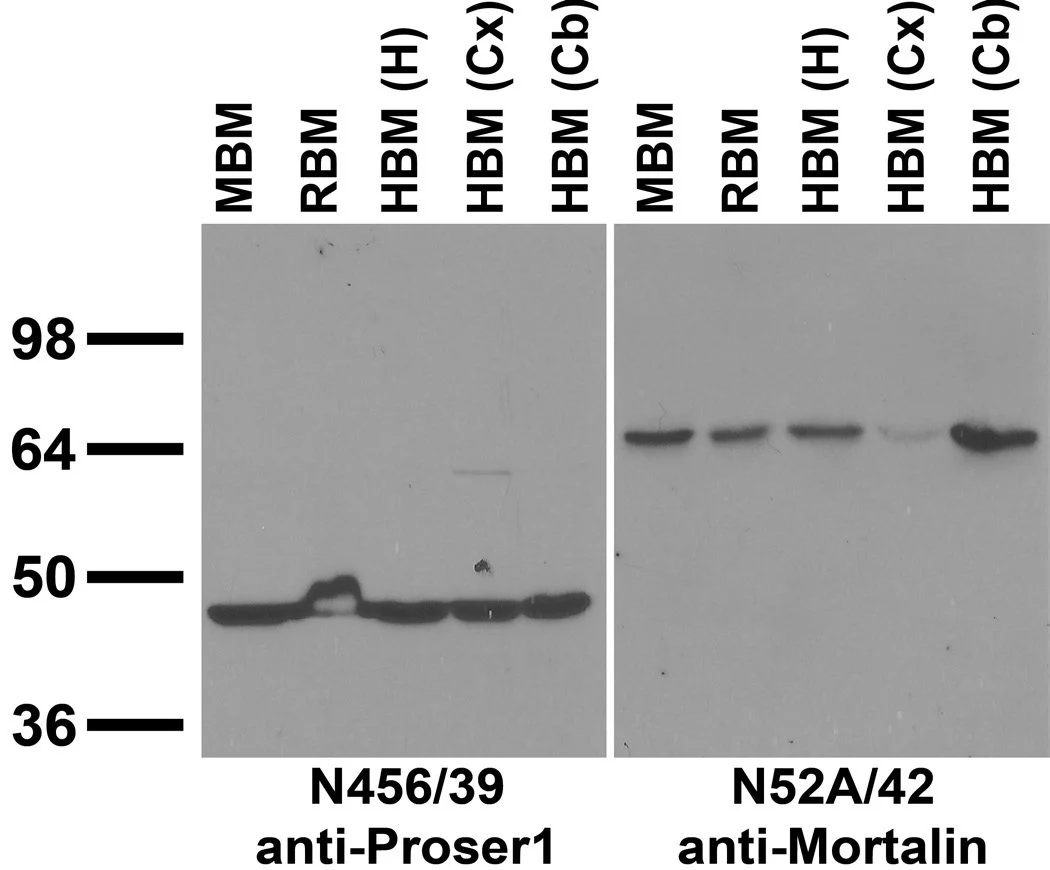 Anti-Proser1 Antibody