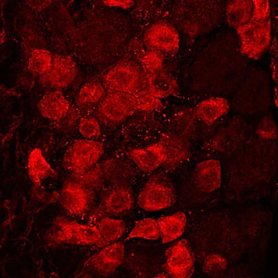 Anti-Prostatic Acid Phosphatase (PAP) Antibody