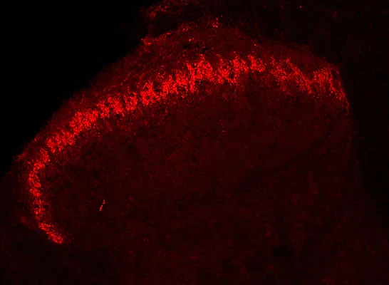Anti-Prostatic Acid Phosphatase (PAP) Antibody - Image 3
