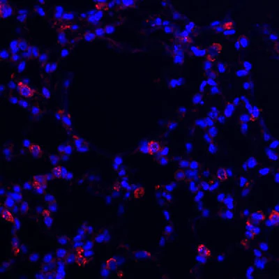 Anti-Prosurfactant Protein C Antibody