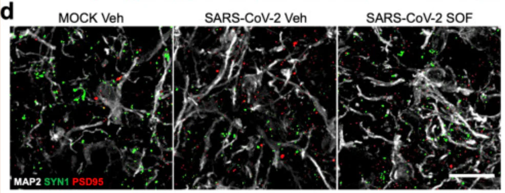 Anti-PSD-95 Antibody - Image 10