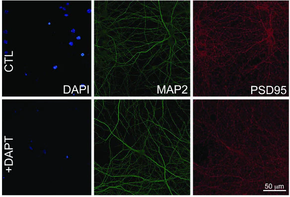 Anti-PSD-95 Antibody - Image 13