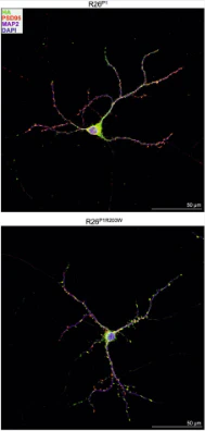 Anti-PSD-95 Antibody - Image 16