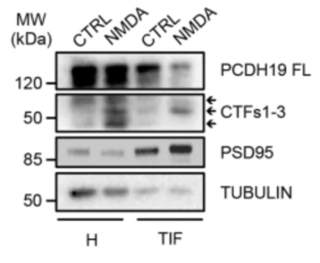 Anti-PSD-95 Antibody - Image 5
