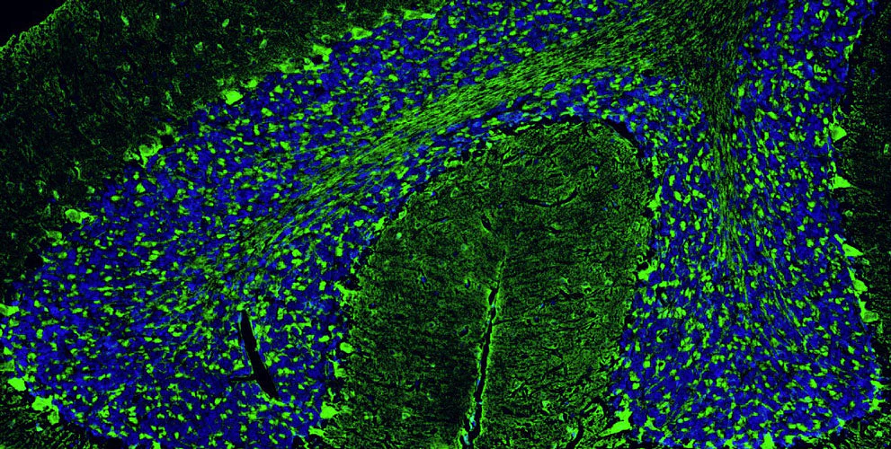Anti-PSD-95 Recombinant Guinea Pig Chimeric mAb