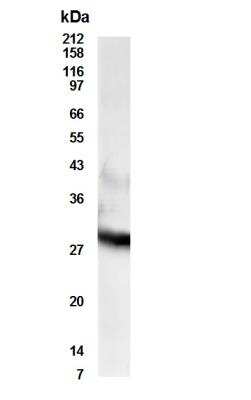 Anti-PSDR1 (RDH11) Antibody