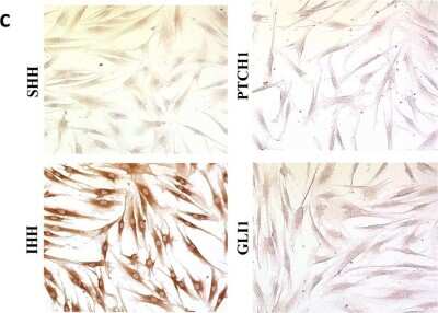 Anti-PTCH1 Antibody