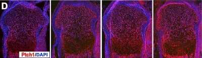 Anti-PTCH1 Antibody - Image 2