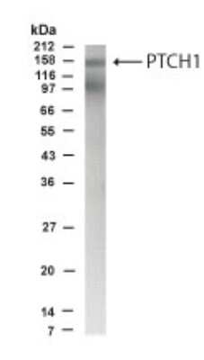 Anti-PTCH1 Antibody - Image 3