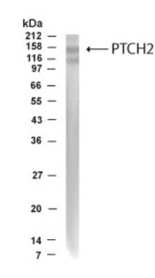 Anti-PTCH2 Antibody