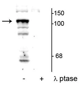 Anti-PTPH1 (Ser459) Antibody