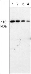 Anti-PYK2 (C-terminal region) Antibody