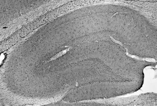 Anti-QKI-6 Antibody