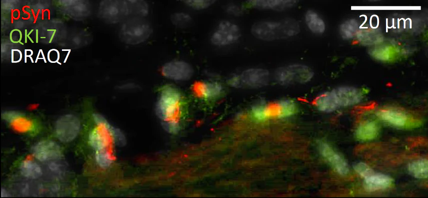 Anti-QKI-7 Antibody - Image 5