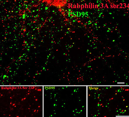Anti-Rabphilin 3A (Ser234) Antibody - Image 2