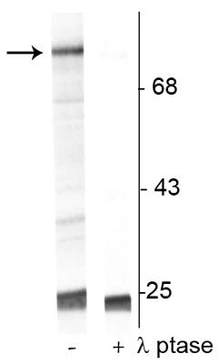Anti-Raf-1 (Ser301) Antibody