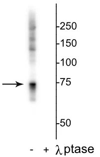 Anti-Raf-1 (Ser642) Antibody