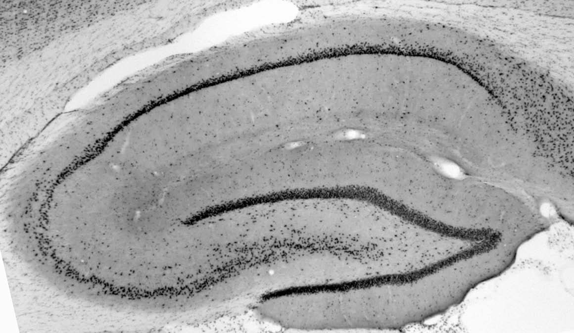 Anti-RBM17/SPF45 Antibody