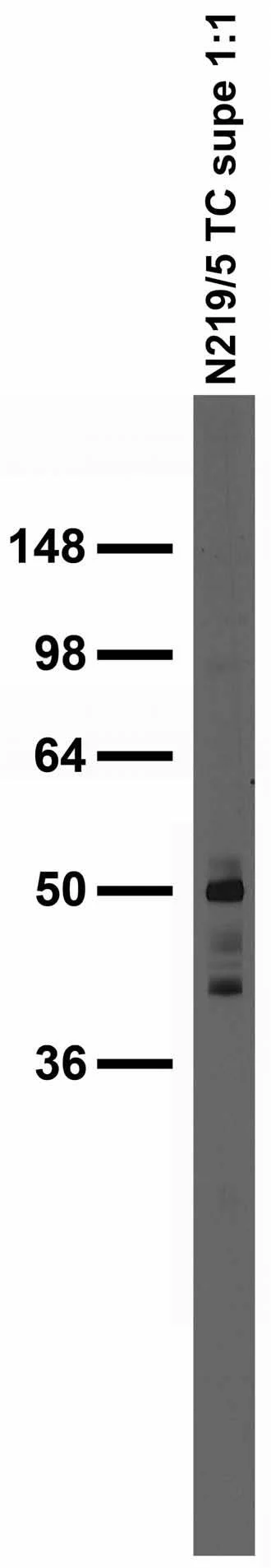 Anti-RBM17/SPF45 Antibody - Image 2