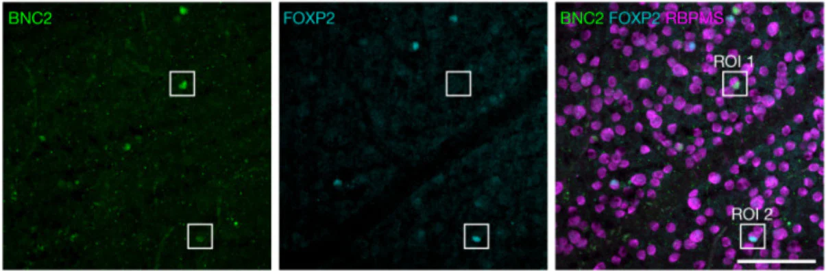 Anti-RBPMS Antibody - Image 7