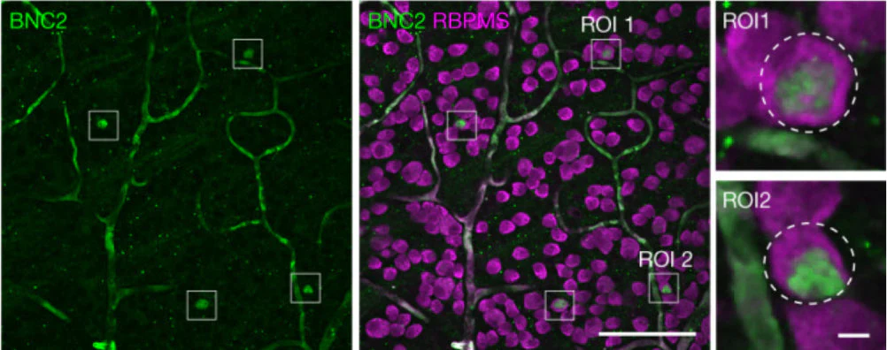 Anti-RBPMS Antibody - Image 8