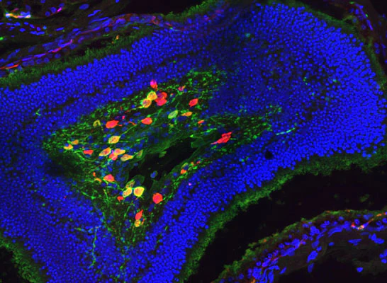 Anti-RBPMS Antibody