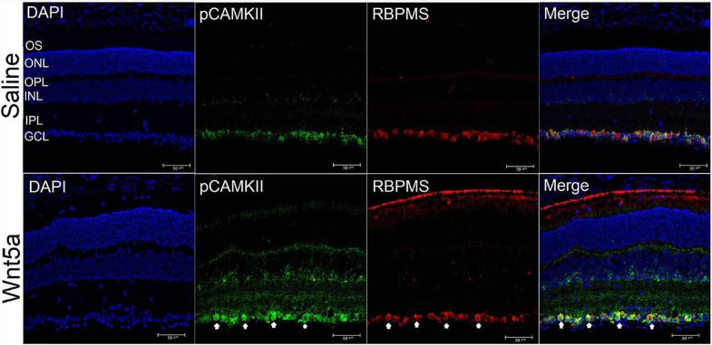 Anti-RBPMS Antibody - Image 10