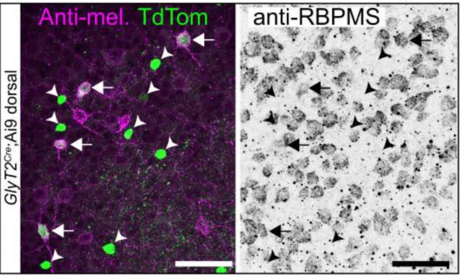 Anti-RBPMS Antibody - Image 14