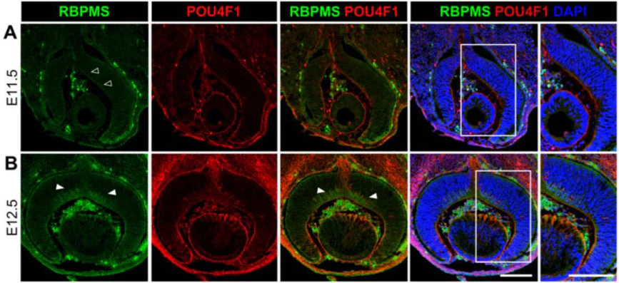 Anti-RBPMS Antibody - Image 17