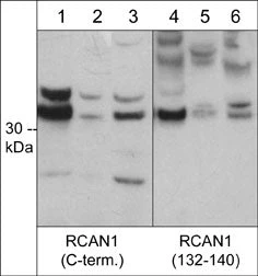 Anti-RCAN1/Dscr1 (central region) Antibody