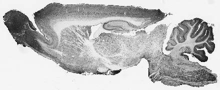 Anti-REEP Antibody - Image 2